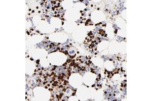 Immunohistochemical staining of human bone marrow with S100A12 polyclonal antibody  shows strong nuclear positivity in bone marrow poietic cells at 1:500-1:1000 dilution.