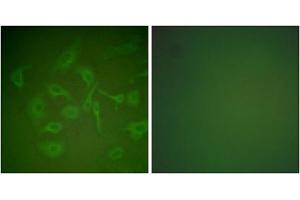 Immunofluorescence analysis of HepG2 cells, using Mammaglobin Antibody (ABIN2843548). (Mammaglobin anticorps  (Internal Region))