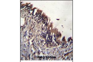 NUDT9 Antibody (C-term) (ABIN656174 and ABIN2845504) immunohistochemistry analysis in formalin fixed and paraffin embedded human lung tissue followed by peroxidase conjugation of the secondary antibody and DAB staining. (NUDT9 anticorps  (C-Term))