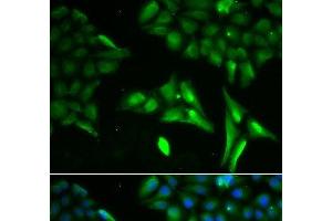 Immunofluorescence analysis of U2OS cells using ACADS Polyclonal Antibody (ACADS anticorps)