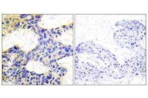 Immunohistochemistry (IHC) image for anti-Ribosomal Protein S6 Kinase, 70kDa, Polypeptide 1 (RPS6KB1) (Internal Region) antibody (ABIN1849255) (RPS6KB1 anticorps  (Internal Region))