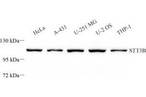 Western blot analysis of STT3B (ABIN7075745) at dilution of 1: 2000 (STT3B anticorps)