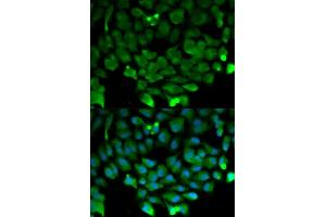 Immunofluorescence analysis of HeLa cell using CUL3 antibody. (Cullin 3 anticorps  (AA 569-768))