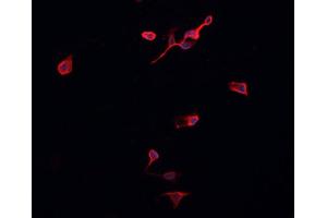 ABIN6276954 staining HepG2? (Peroxiredoxin 2 anticorps  (C-Term))
