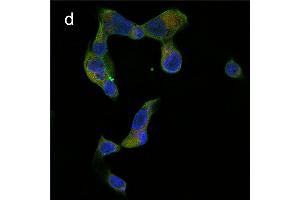 Detection of cathepsin B (CB) activity in Eca-109 cells by the CB probe. (Chèvre anti-Lapin IgG Anticorps (FITC))