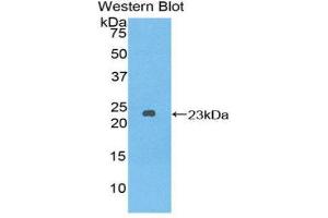 Western Blotting (WB) image for anti-Dishevelled, Dsh Homolog 2 (Drosophila) (DVL2) (AA 78-250) antibody (ABIN1858675) (DVL2 anticorps  (AA 78-250))