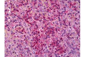 Anti-IL6R antibody IHC of human spleen. (IL-6 Receptor anticorps)