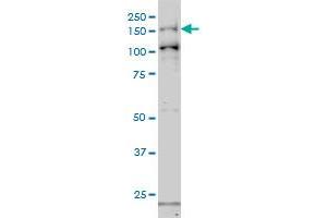 GAK monoclonal antibody (M01), clone 4C10 Western Blot analysis of GAK expression in Hela S3 NE . (GAK anticorps  (AA 151-250))