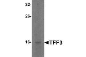 Western blot analysis of TFF3 in rat small intestine tissue lysate with TFF3 antibody at 2 μg/ml. (TFF3 anticorps  (C-Term))