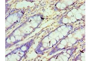 Immunohistochemistry of paraffin-embedded human colon tissue using ABIN7148780 at dilution of 1:100 (CXXC1 anticorps  (AA 1-210))