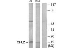 Western blot analysis of extracts from Jurkat/HeLa cells, using Cofilin Antibody. (Cofilin anticorps  (AA 61-110))