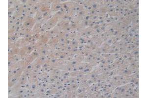 IHC-P analysis of Human Liver Tissue, with DAB staining. (DCLK1 anticorps  (AA 390-647))