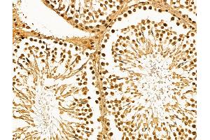 ABIN7094608 and ABIN7098658 at 1/100 staining Rat testis tissue by IHC-P.