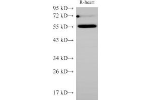 Western Blot analysis of Rat Heart using Ceacam1 Polycloanl Antibody at dilution of 1:1000 (CEACAM1 anticorps)