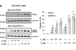 Thyroid hormone induced proliferation in ovarian cancer cellsOVCAR-3 and SKOV-3 were treated with T3 (10-9 to 10-7 M) or T4 (10-8 to 10-6 M) for 3 days (A), 24 hours (B, upper panel) or 30 min (B, lower panel). (PCNA anticorps)