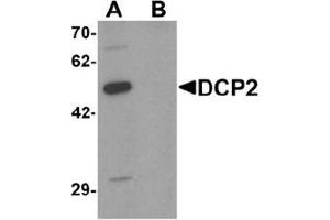 Western blot analysis of DCP2 in 293 cell lysate with DCP2 Antibody  at 1 μg/ml in (A) the absence and (B) the presence of blocking peptide. (DCP2 anticorps  (C-Term))
