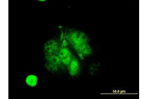 Immunofluorescence of monoclonal antibody to MEF2A on MCF-7 cell.