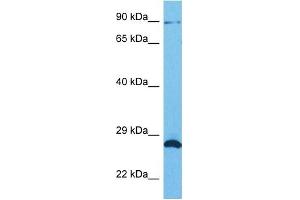 Host:  Rabbit  Target Name:  SUN1  Sample Tissue:  Human HCT116 Whole Cell  Antibody Dilution:  1ug/ml (SUN1 anticorps  (N-Term))