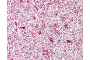 Anti-ATF1 antibody IHC of human spleen.