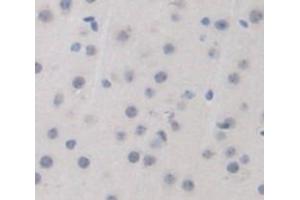 Used in DAB staining on fromalin fixed paraffin- embedded brain tissue