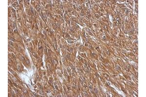 IHC-P Image Immunohistochemical analysis of paraffin-embedded U87 xenograft, using GPR37L1, antibody at 1:500 dilution.