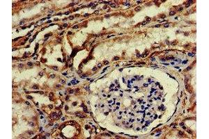 IHC image of ABIN7168921 diluted at 1:200 and staining in paraffin-embedded human kidney tissue performed on a Leica BondTM system.