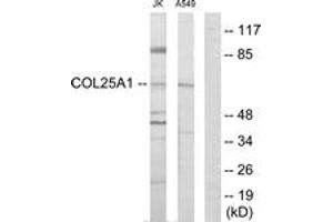 Western Blotting (WB) image for anti-Collagen, Type XXV, alpha 1 (COL25A1) (AA 101-150) antibody (ABIN2889929) (COL25A1 anticorps  (AA 101-150))