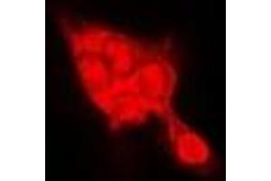 Immunofluorescent analysis of SELENBP1 staining in Hela cells.