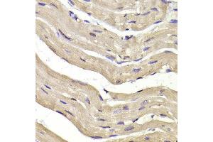 Immunohistochemistry of paraffin-embedded Mouse heart using COPS3 antibody at dilution of 1:100 (x400 lens).