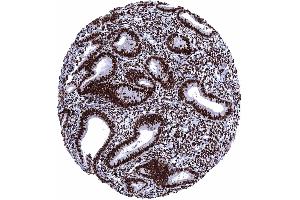 Uterus endometrium proliferation Among normal tissues highest levels of ER immunostaining occur in epithelial and stromal cells of the endometrium
