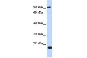 MCM7 antibody used at 1 ug/ml to detect target protein. (MCM7 anticorps  (Middle Region))