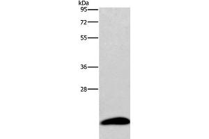 Western Blot analysis of Human testis tissue using AURKAIP1 Polyclonal Antibody at dilution of 1:600 (AURKAIP1 anticorps)