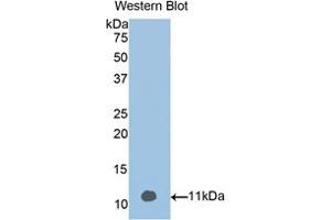 Western blot analysis of the recombinant protein. (Vitamin D-Binding Protein anticorps  (AA 395-473))