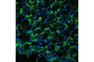 Immunohistochemistry analysis using Rabbit Anti-Aquaporin 1 Polyclonal Antibody .