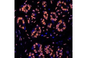 Immunofluorescence (IF) image for anti-Structural Maintenance of Chromosomes 1A (SMC1A) (C-Term) antibody (ABIN7455193) (Recombinant SMC1A anticorps  (C-Term))