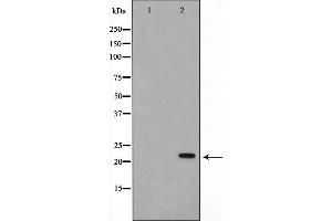 Western blot analysis on Jurkat cell lysate using AKAP14 Antibody,The lane on the left is treated with the antigen-specific peptide. (AKAP14 anticorps  (N-Term))
