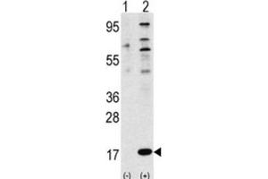 Western Blotting (WB) image for anti-Finkel-Biskis-Reilly Murine Sarcoma Virus (FBR-MuSV) Ubiquitously Expressed (FAU) antibody (ABIN2998455) (FAU anticorps)