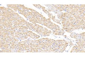 Detection of H-FABP in Bovine Cardiac Muscle Tissue using Polyclonal Antibody to Heart-type Fatty Acid Binding Protein (H-FABP)