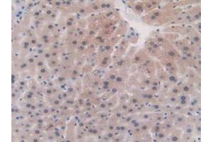 Detection of FBN1 in Mouse Liver Tissue using Polyclonal Antibody to Fibrillin 1 (FBN1)