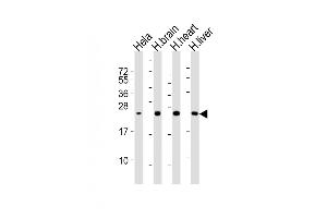 All lanes : Anti-SD Antibody at 1:2000 dilution Lane 1: Hela whole cell lysates Lane 2: human brain lysates Lane 3: human heart lysates Lane 4: human liver lysates Lysates/proteins at 20 μg per lane. (SOD2 anticorps)