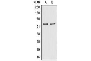 Western blot analysis of ALDH2 expression in HegG2 (A), A549 (B) whole cell lysates.
