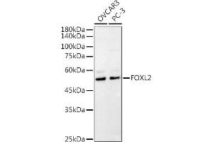 Western blot analysis of extracts of various cell lines, using (ABIN7267239) at 1:1000 dilution.