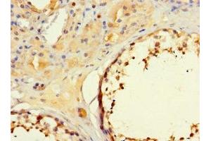Immunohistochemistry of paraffin-embedded human testis tissue using ABIN7160194 at dilution of 1:100