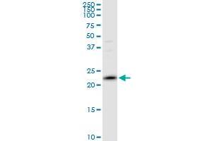 PRDX2 MaxPab polyclonal antibody. (Peroxiredoxin 2 anticorps  (AA 1-198))