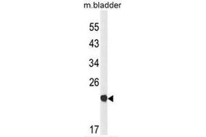 Western blot analysis of CLDN23 Antibody (C-term) in mouse bladder tissue lysates (35µg/lane). (Claudin 23 anticorps  (C-Term))