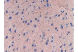 Detection of F5 in Mouse Cerebrum Tissue using Polyclonal Antibody to Coagulation Factor V (F5)