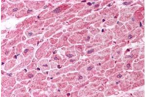 Human Heart (formalin-fixed, paraffin-embedded) stained with TICAM1 antibody ABIN457458 at 10 ug/ml followed by biotinylated goat anti-rabbit IgG secondary antibody ABIN481713, alkaline phosphatase-streptavidin and chromogen. (TICAM1 anticorps  (C-Term))