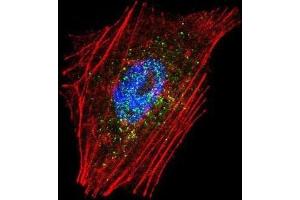 Immunofluorescence (IF) image for anti-Parkinson Protein 2, E3 Ubiquitin Protein Ligase (Parkin) (PARK2) antibody (ABIN3002635)