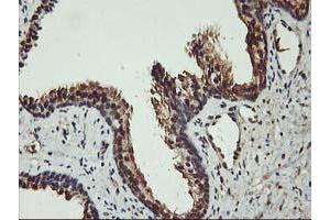 Image no. 8 for anti-V-Akt Murine Thymoma Viral Oncogene Homolog 1 (AKT1) antibody (ABIN1496554) (AKT1 anticorps)