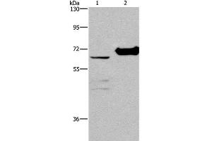 Western Blot analysis of 231 cell and Mouse kidney tissue using CHDH Polyclonal Antibody at dilution of 1:400 (CHDH anticorps)